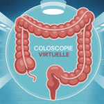 coloscopie virtuelle vue 3D scanner médical